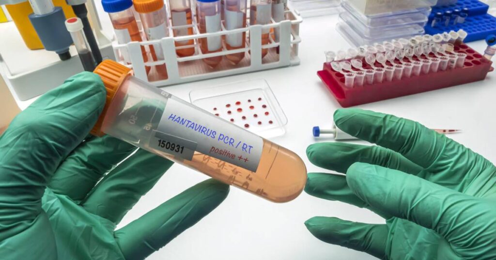 Imagen de un laboratorio de salud pública trabajando en una prueba PCR para detectar el hantavirus