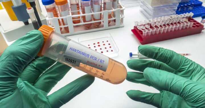 Desarrollan en EE. UU. la primera prueba PCR para detectar hantavirus en fases tempranas