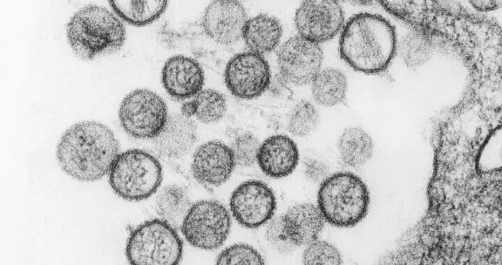 ¿por qué el hantavirus es más letal para algunas personas que para otras?