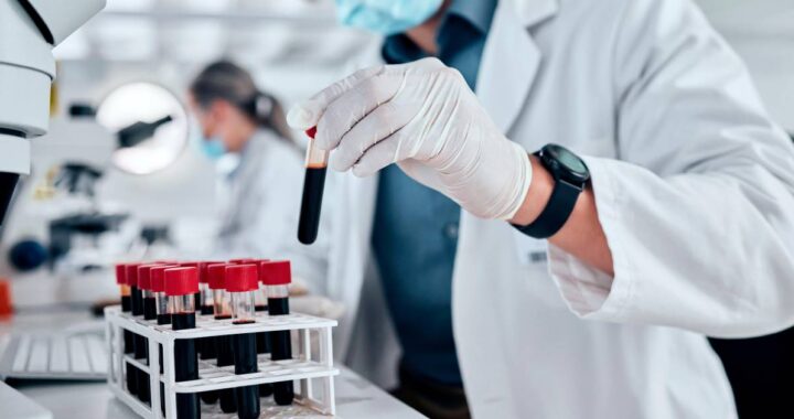 Desarrollan test de sangre para detectar cáncer en solo minutos: así funciona