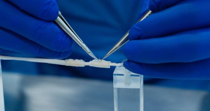 Empresas paisas crean dispositivo que regenera nervios dañados y se disuelve en el cuerpo